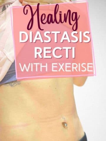 cropped-Diastasis-recti-healing-pin-3.jpg